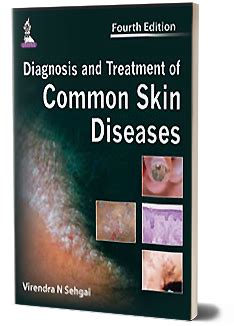 JaypeeDigital | Instant Diagnostic Criteria and Treatment of Common ...