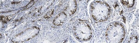 Anti-Podoplanin Antibody, clone LpMab-13 | MABT855