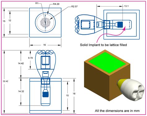 Hybrid Biomechanical Design of Dental Implants: Integrating Solid and ...