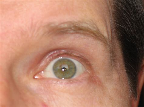 desintoxicacion-mirtha.blogspot.com: ganglios linfaticos inflamados