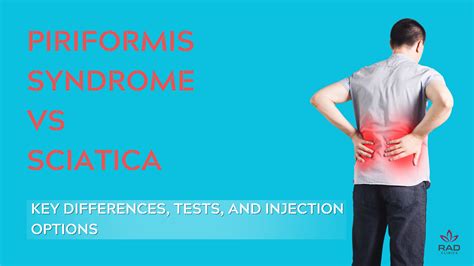 Piriformis Syndrome vs Sciatica - RAD Clinics