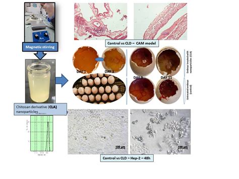 Designing of Chitosan Derivatives Nanoparticles with Antiangiogenic ...
