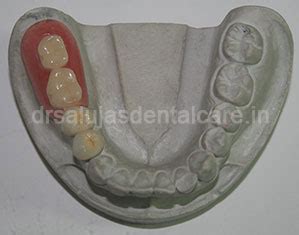 Dr. Saluja's family dental care centre|Dentist in Mumbai|Cosmetic ...