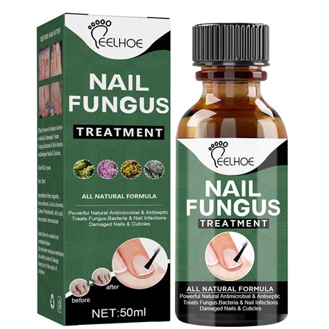 Buy Nail Fungal Extra Strong Nail Repair Set, Fingernail & Toenail Care ...