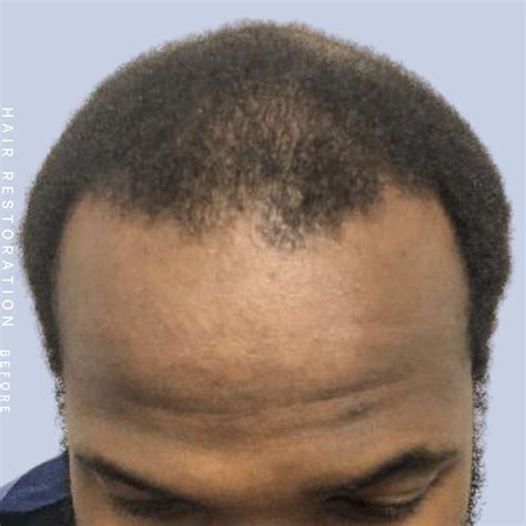 Image result for Reconstructing