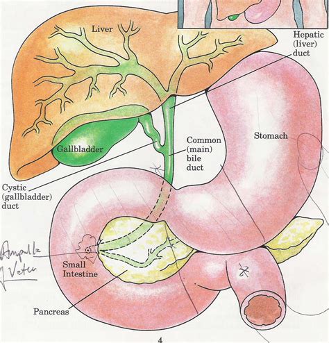 sweetlee: Peri-Ampullary Cancer Survivor