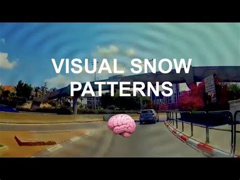 Image result for Visual Snow Simulator