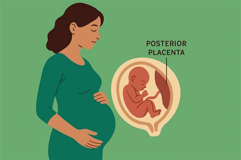 Posterior Placenta: Meaning, Position & Pregnancy Impact