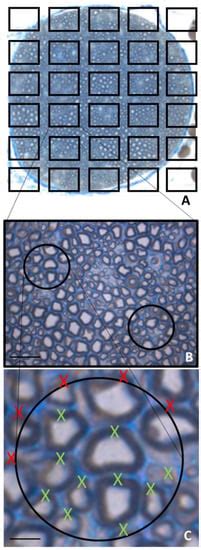 Morphological Methods to Evaluate Peripheral Nerve Fiber Regeneration ...