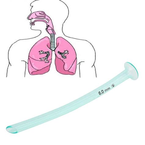 Health Care Airway, Disposable Nasal Pharyngeal Duct Nasopharyngeal ...