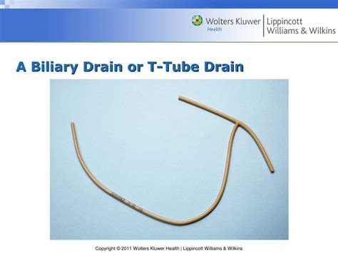 PPT - Chapter 8 Skin Integrity and Wound Care PowerPoint Presentation ...