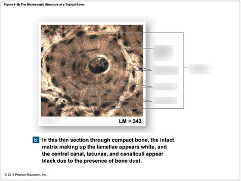 Microscopic Bone Matrix Figure 的图像结果