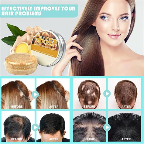 Buy Ginger Hair Regrowth Shampoo Bar,Ginger Shampoo Bar,Anti Hair Loss ...