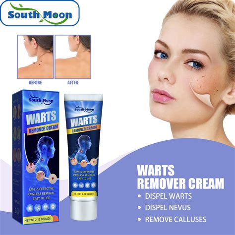 South Moon Wart Removal Mole Remedy Liquid Pen Treatment Wart Remover Ointment For Skin Wart ...