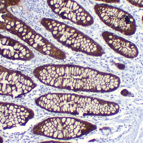 VILLIN -ACBP | PathnSitu biotechnologies
