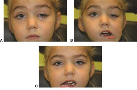 Flash cards (Part 2): Diseases of Nerves and Muscles – Dentowesome
