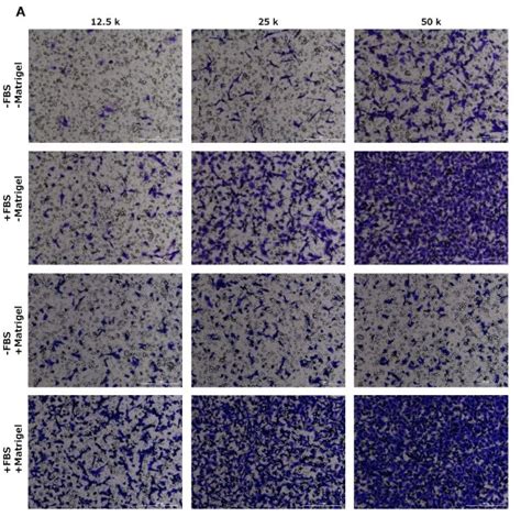 Cell Migration and Invasion Assay Guidance using Millicell® Cell ...