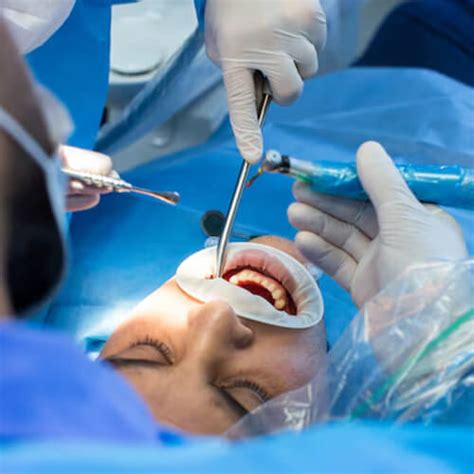 Oral & Maxillofacial Surgery Department at Panacea Superspeciality ...