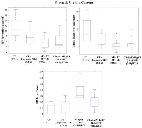 Cancers | Special Issue : Prostate Cancer Radiotherapy: Recent Advances ...