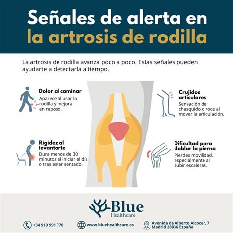 Anatomía De La Rodilla Síntomas Del Dolor