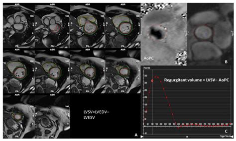 Diagnostics | March-2 2024 - Browse Articles