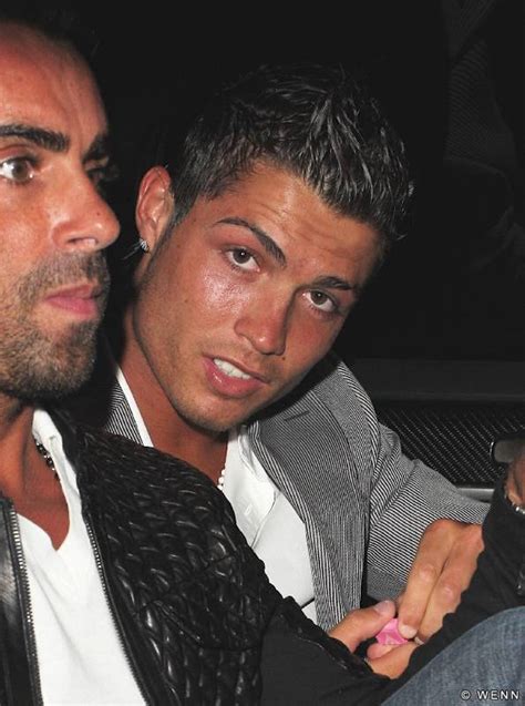 Cristiano Ronaldo Facial Surgery