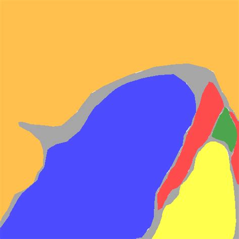 Laryngeal Endoscopic - Dataset Ninja