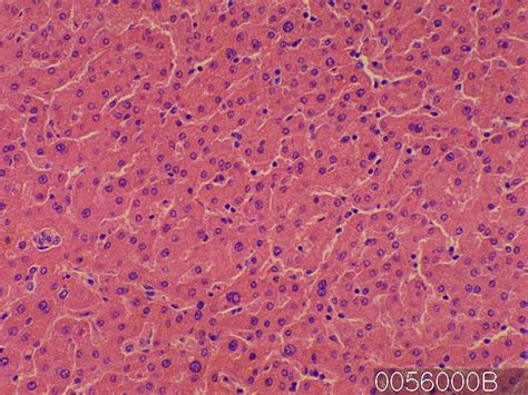 Image result for Normal Liver Function