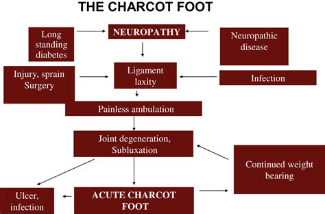 Charcot Neuroarthropathy of the Foot and Ankle: A Review - The Journal of Foot and Ankle Surgery