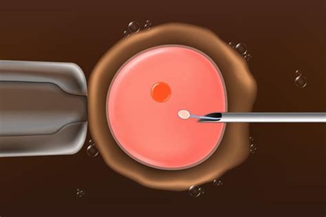 ICSI vs IVF: Which Fertility Treatment is Right for You?