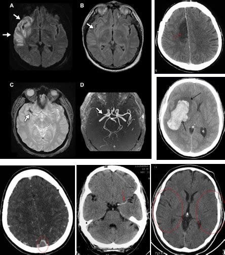 Image result for AVC Video Explicative