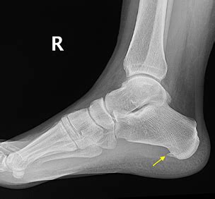 Best Ayurvedic Clinic in Baner, Balewadi, Pune