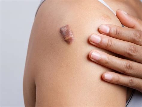 Dyutih Clinics Skin & Hair Clinic - Best Plastic Surgery Clinic in Kompally