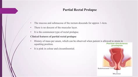 RECTAL prolapse.pptx