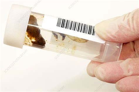 Image result for LabCorp Stool Specimen Collection Kit