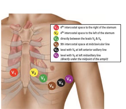 Image result for Lead Optimization Mapper Algorithm