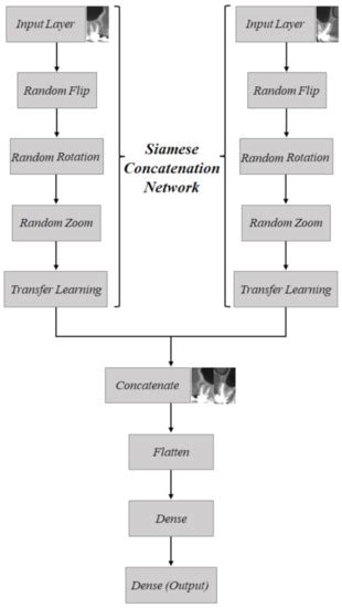Automatic Classification System for Periapical Lesions in Cone-Beam ...
