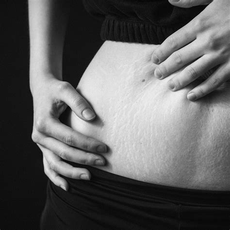 STRETCHMARKS – Vann Essentials