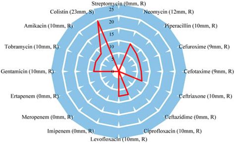 RETRACTED: Isolation and Characterization of a Novel Lytic Phage, vB ...