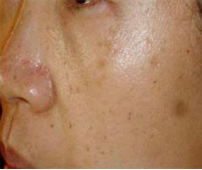 肤色发黄脸色发黄暗沉是什么原因引起的2022已更新今日动态