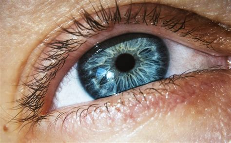Why Am I Seeing Yellow Spots? - Belmont Eye Center