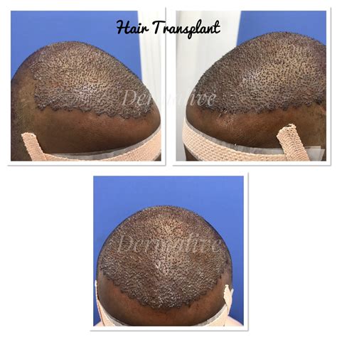 Dermalive Skin Clinic