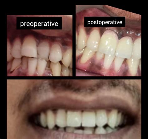US Bench Test Preparation - Delhi Dental Academy