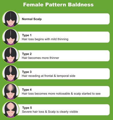 Female Pattern Baldness | Dr. Aditi's Homeopathy Hair Clinic