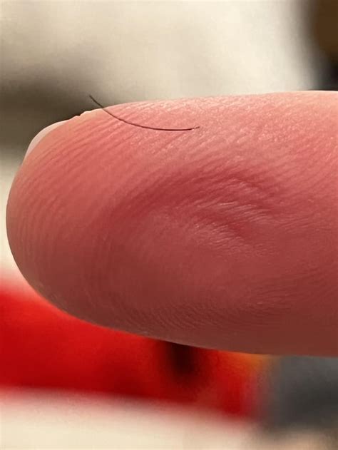 Image result for Hair Splinter Infection