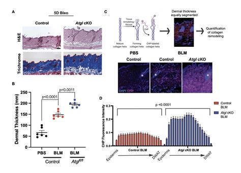 Exploring the Link Between Atgl-Dependent Lipolysis and Dermal Fibrosis ...