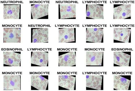 Deep and Hybrid Learning Techniques for Diagnosing Microscopic Blood ...