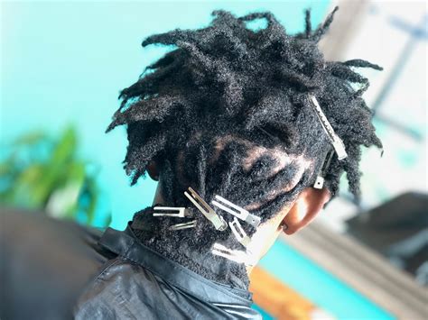 How to Stop Itchy Scalp with Locs - Dr Locs