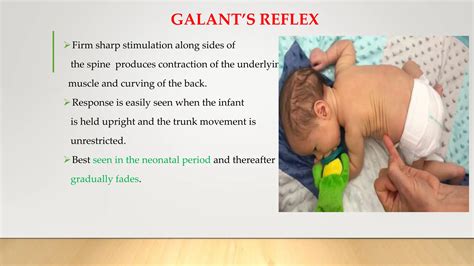neonatal reflex.pptx