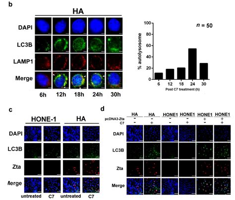 Autophagy-Dependent Reactivation of Epstein-Barr Virus Lytic Cycle and ...